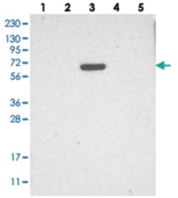 C8B, Rabbit, Polyclonal Antibody, Abnova 100&mu;L; Unlabeled:Antibodies,