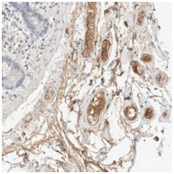 C8B, Rabbit, Polyclonal Antibody, Abnova 100&mu;L; Unlabeled:Antibodies,
