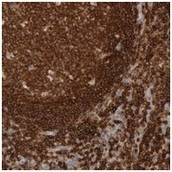 RUNDC1, Rabbit, Polyclonal Antibody, Abnova 100 &mu;L | Buy Online | Abnova | Fisher Scientific