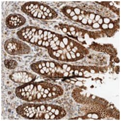 KIFAP3 Rabbit anti-Human, Polyclonal Antibody, Abnova 100 &mu;L | Buy Online | Abnova Corporation | Fisher Scientific