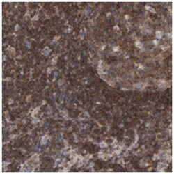 TEFM, Rabbit, Polyclonal Antibody, Abnova 100 &mu;L | Buy Online | Abnova Corporation | Fisher Scientific