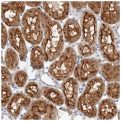 METRNL, Rabbit, Polyclonal Antibody, Abnova 100&mu;L; Unlabeled:Antibodies,