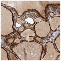 C17orf48 Rabbit anti-Human, Polyclonal Antibody, Abnova 100&mu;L; Unlabeled:Antibodies,