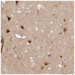 ZNF521 Rabbit anti-Human, Polyclonal Antibody, Abnova 100 &mu;L | Buy Online | Abnova Corporation | Fisher Scientific