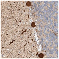 AFMID Rabbit anti-Human, Polyclonal Antibody, Abnova 100 &mu;L | Buy Online | Abnova Corporation | Fisher Scientific