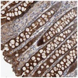 C9orf72, Rabbit, Polyclonal Antibody, Abnova 100 &mu;L | Buy Online | Abnova Corporation | Fisher Scientific