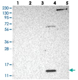PSMG3, Rabbit, Polyclonal Antibody, Abnova 100&mu;L; Unlabeled:Antibodies,