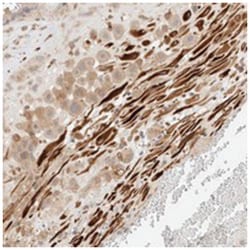 FAT1 Rabbit anti-Human, Polyclonal Antibody, Abnova 100 &mu;L | Buy Online | Abnova Corporation | Fisher Scientific