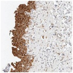 TBC1D8B Rabbit anti-Human, Polyclonal Antibody, Abnova 100&mu;L; Unlabeled:Antibodies,