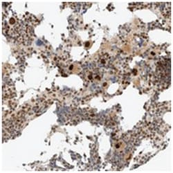 ZBTB34 Rabbit anti-Human, Polyclonal Antibody, Abnova 100 &mu;L | Buy Online | Abnova Corporation | Fisher Scientific
