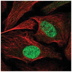 ZBTB34 Rabbit anti-Human, Polyclonal Antibody, Abnova 100 &mu;L | Buy Online | Abnova Corporation | Fisher Scientific