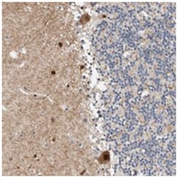 ZNF703, Rabbit, Polyclonal Antibody, Abnova 100&mu;L; Unlabeled:Antibodies,