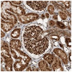 GIGYF1 Rabbit anti-Human, Polyclonal Antibody, Abnova 100 &mu;L | Buy Online | Abnova Corporation | Fisher Scientific