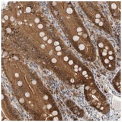 WIPF2 Rabbit anti-Human, Polyclonal Antibody, Abnova 100 &mu;L | Buy Online | Abnova Corporation | Fisher Scientific