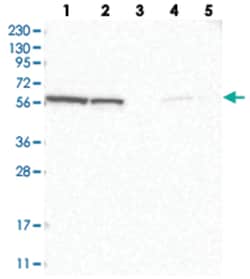 GOPC Rabbit anti-Human, Polyclonal Antibody, Abnova 100&mu;L; Unlabeled:Antibodies,