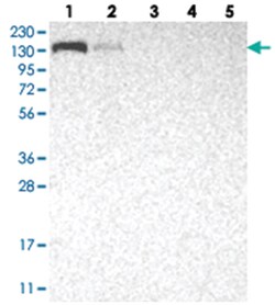 AZI1 Rabbit anti-Human, Polyclonal Antibody, Abnova 100&mu;L; Unlabeled:Antibodies,