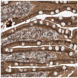 SPAG7, Rabbit, Polyclonal Antibody, Abnova 100 &mu;L | Buy Online | Abnova Corporation | Fisher Scientific