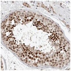 ZFP91, Rabbit, Polyclonal Antibody, Abnova 100 &mu;L | Buy Online | Abnova Corporation | Fisher Scientific