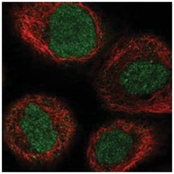 ZFP91, Rabbit, Polyclonal Antibody, Abnova 100 &mu;L | Buy Online | Abnova Corporation | Fisher Scientific