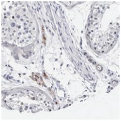 CATSPERD, Rabbit, Polyclonal Antibody, Abnova 100&mu;L; Unlabeled:Antibodies,