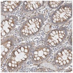 C9orf82 Rabbit anti-Human, Polyclonal Antibody, Abnova 100 &mu;L | Buy Online | Abnova Corporation | Fisher Scientific