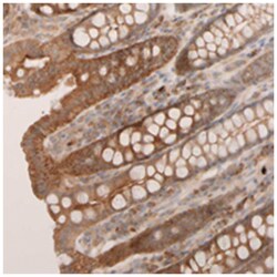 VSTM2A Rabbit anti-Human, Polyclonal Antibody, Abnova 100 &mu;L | Buy Online | Abnova Corporation | Fisher Scientific