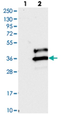 VSTM2A Rabbit anti-Human, Polyclonal Antibody, Abnova 100 &mu;L | Buy Online | Abnova Corporation | Fisher Scientific