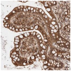 RP5-1000E104 Rabbit anti-Human, Polyclonal Antibody, Abnova 100 &mu;L | Buy Online | Abnova Corporation | Fisher Scientific