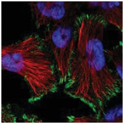 RP5-1000E104 Rabbit anti-Human, Polyclonal Antibody, Abnova 100 &mu;L | Buy Online | Abnova Corporation | Fisher Scientific