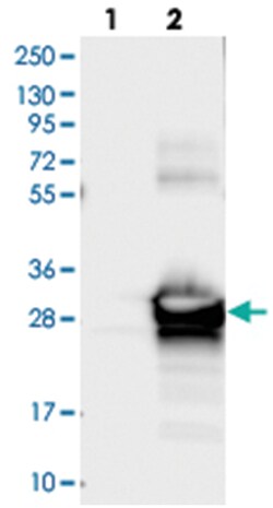 RP5-1000E104 Rabbit anti-Human, Polyclonal Antibody, Abnova 100 &mu;L | Buy Online | Abnova Corporation | Fisher Scientific