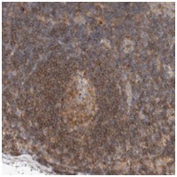 C8orf37, Rabbit, Polyclonal Antibody, Abnova 100 &mu;L | Buy Online | Abnova Corporation | Fisher Scientific