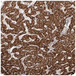 WDR91, Rabbit, Polyclonal Antibody, Abnova 100 &mu;L | Buy Online | Abnova Corporation | Fisher Scientific