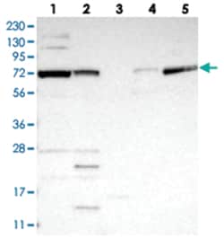 FBXO43 Rabbit anti-Human, Polyclonal Antibody, Abnova 100 &mu;L | Buy Online | Abnova Corporation | Fisher Scientific
