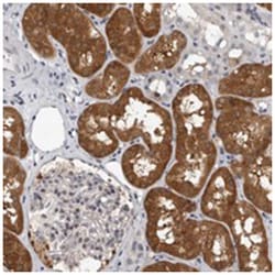 FBXO43 Rabbit anti-Human, Polyclonal Antibody, Abnova 100 &mu;L | Buy Online | Abnova Corporation | Fisher Scientific