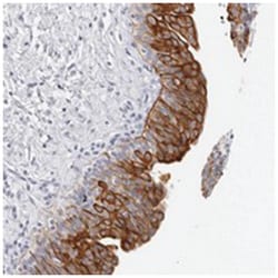 RPH3AL, Rabbit, Polyclonal Antibody, Abnova 100&mu;L; Unlabeled:Antibodies,