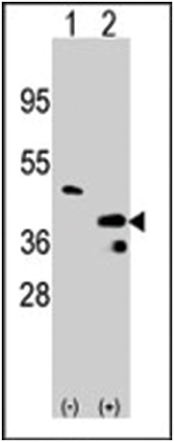 PRMT1 Rabbit anti-Human, Polyclonal Antibody, Abnova 400&mu;L; Unlabeled:Antibodies,