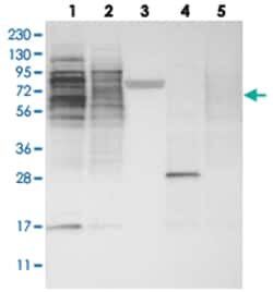 ZSCAN2, Rabbit, Polyclonal Antibody, Abnova 100 &mu;L | Buy Online | Abnova Corporation | Fisher Scientific