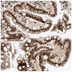 ZSCAN2, Rabbit, Polyclonal Antibody, Abnova 100 &mu;L | Buy Online | Abnova Corporation | Fisher Scientific
