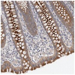 OTOR, Rabbit, Polyclonal Antibody, Abnova 100 &mu;L | Buy Online | Abnova | Fisher Scientific