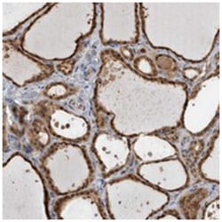 USH1G, Rabbit, Polyclonal Antibody, Abnova 100&mu;L; Unlabeled:Antibodies,