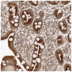 GCN1L1 Rabbit anti-Human, Polyclonal Antibody, Abnova 100 &mu;L | Buy Online | Abnova Corporation | Fisher Scientific