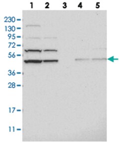 ADSS, Rabbit, Polyclonal Antibody, Abnova 100 &mu;L | Buy Online | Abnova Corporation | Fisher Scientific