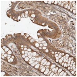 ADSS, Rabbit, Polyclonal Antibody, Abnova 100 &mu;L | Buy Online | Abnova Corporation | Fisher Scientific