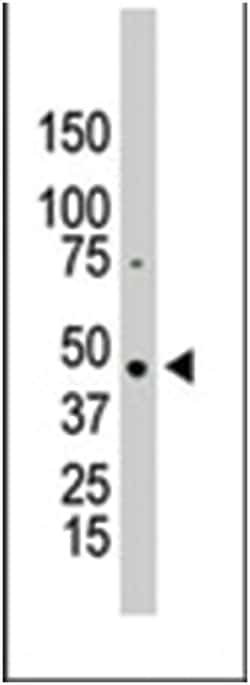 PRMT2 Rabbit anti-Human, Polyclonal Antibody, Abnova 400&mu;L; Unlabeled:Antibodies,