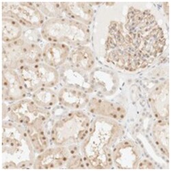 TSR1, Rabbit, Polyclonal Antibody, Abnova 100&mu;L; Unlabeled:Antibodies,