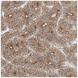 CHMP6 Rabbit anti-Human, Polyclonal Antibody, Abnova 100 &mu;L | Buy Online | Abnova Corporation | Fisher Scientific