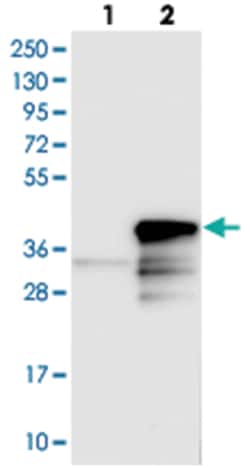 CHMP6 Rabbit anti-Human, Polyclonal Antibody, Abnova 100 &mu;L | Buy Online | Abnova Corporation | Fisher Scientific