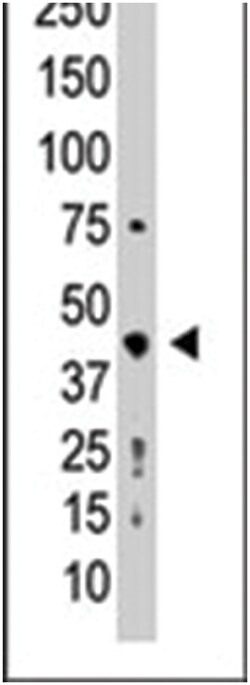 PRMT2 Rabbit anti-Human, Polyclonal Antibody, Abnova 400 &mu;L | Buy Online | Abnova Corporation | Fisher Scientific
