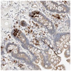 KBTBD5, Rabbit, Polyclonal Antibody, Abnova 100&mu;L; Unlabeled:Antibodies,