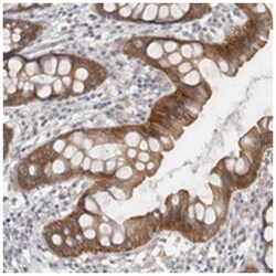 WIPF2 Rabbit anti-Human, Polyclonal Antibody, Abnova 100&mu;L; Unlabeled:Antibodies,